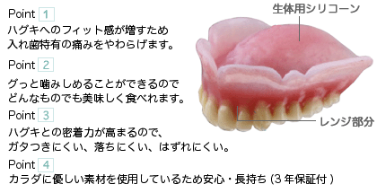 軟性義歯画像